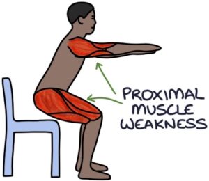 An Nam Y Quán, yếu gốc chi, bệnh tự miễn